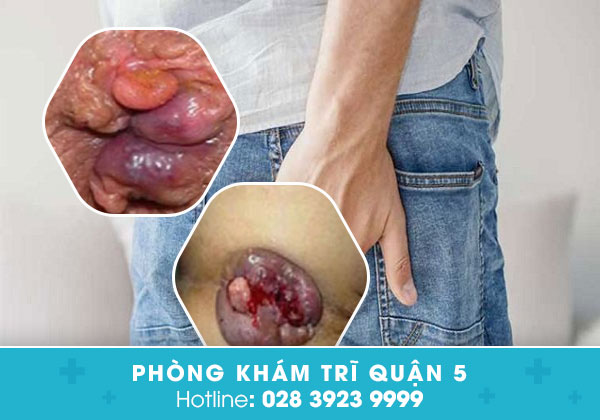 Phòng khám Hoàn Cầu